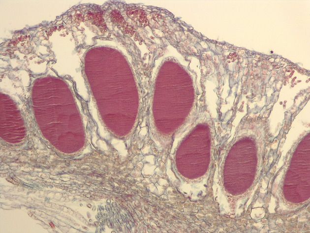 Liverwort Antheridia CS Slides - Liverwort Antheridia CS 02 100X